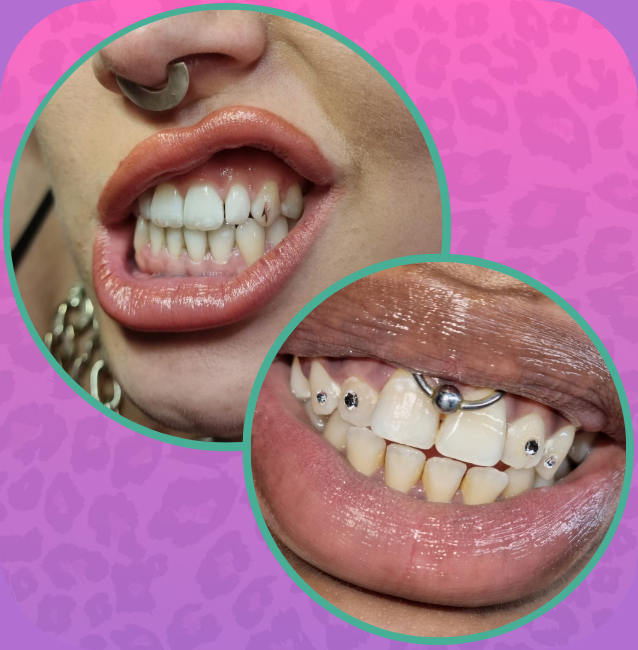 Home page tooth gems